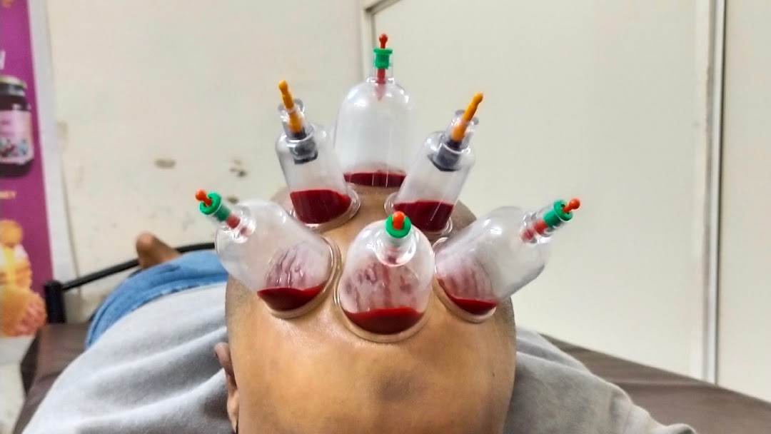 Hijama Therapy Care2curephysiotherapyclinic